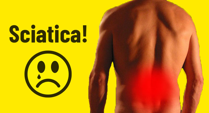 Sciatica Nerve Pain