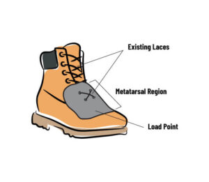 What Is A Metatarsal Guard