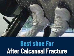 Best Shoe After Calcaneal Fracture